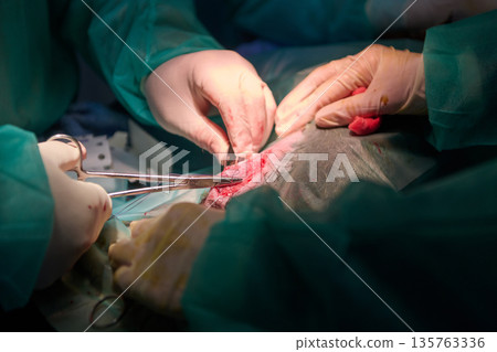 Surgeons Perform Delicate Operation With Surgical Tools During Open Medical Procedure In Operating Room 135763336