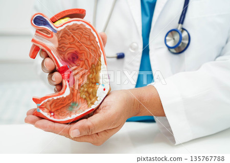Stomach disease, doctor holding anatomy model for study diagnosis and treatment in hospital. 135767788