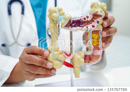Intestine, doctor holding human anatomy model for study diagnosis and treatment in hospital. Intestine, doctor holding human anatomy model for study diagnosis and treatment in hospital. 135767789