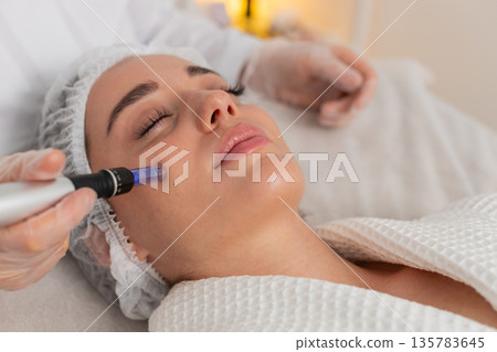 Cosmetologist doing peeling procedure, woman skin regeneration, dermapen microneedling, dermastamp Cosmetologist doing peeling procedure, woman skin regeneration, dermapen microneedling, dermastamp 135783645