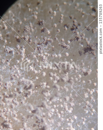 Mold grown on potato dextrose medium Mold grown on potato dextrose medium 135789263