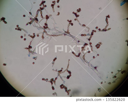 Black mold in the house Black mold in the house 135822620