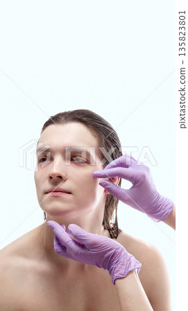 Male skincare consultation with doctor hands touching face. Male skincare consultation with doctor hands touching face. 135823801