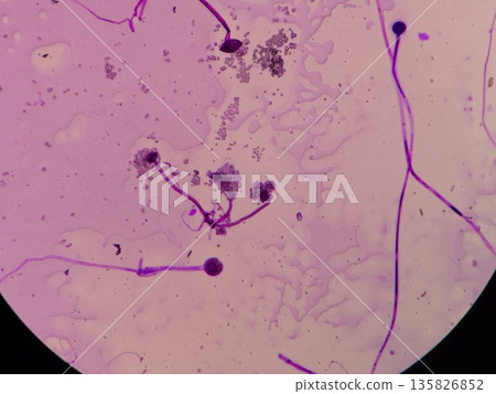 Photo of stained Rhizopus 135826852