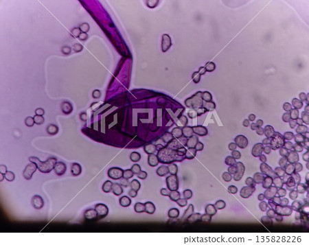 The sporangium has burst open and the spores are coming out. The sporangium has burst open and the spores are coming out. 135828226
