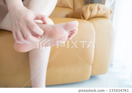 Woman scratching itchy feet that are peeling and cracked. Cause of itchy include athlete's foot (fungal infection), dermatitis (eczema), dry skin, dehydration or sweaty feet. Health care concept. Woman scratching itchy feet that are peeling and cracked. Cause of itchy include athlete's foot (fungal infection), dermatitis (eczema), dry skin, dehydration or sweaty feet. Health care concept. 135834761