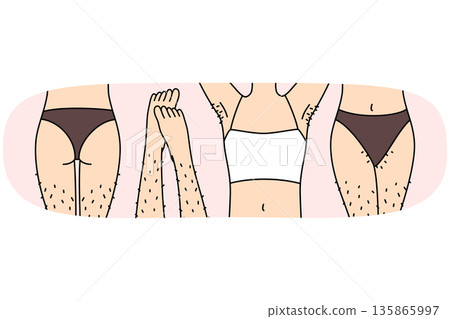 Hairy female legs and thighs in need of depilation or epilation using wax tape and sugaring 135865997