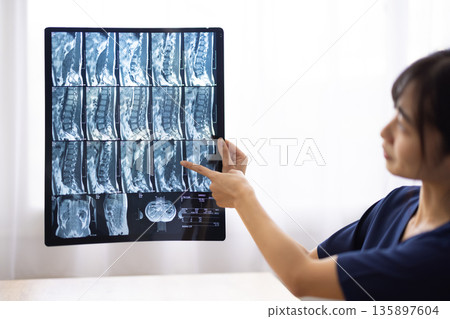 一名身穿藏藍色醫用工作服的女子手持X光片。 135897604