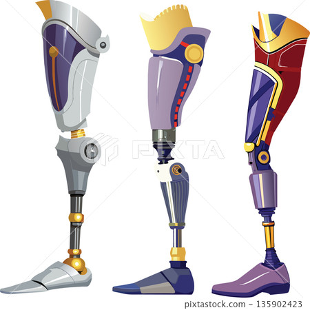 Limb Bionito Amputation and Leg Prosthesis- 135902423