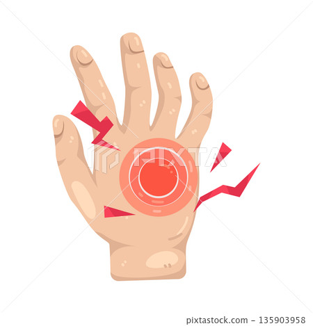 Illustration of hand pain Illustration of hand pain 135903958