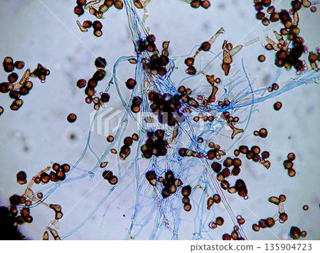 The troublesome mold that grows on refrigerator packing The troublesome mold that grows on refrigerator packing 135904723