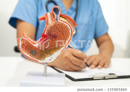 Stomach disease, doctor with anatomy model for study diagnosis and treatment in hospital. 135905884