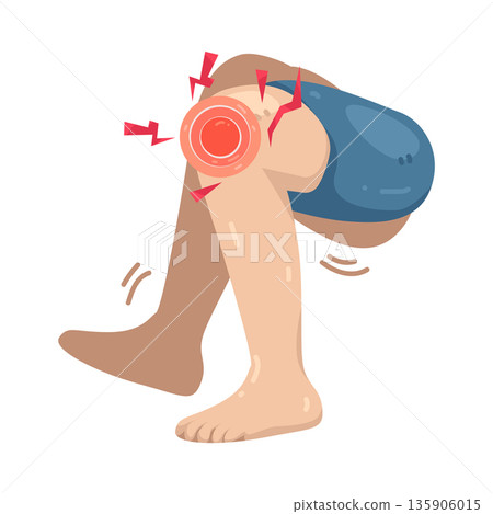 Illustration of knee pain   135906015