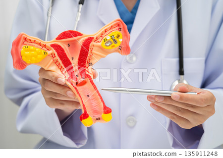 Uterus, doctor holding human anatomy model for study diagnosis and treatment in hospital. Uterus, doctor holding human anatomy model for study diagnosis and treatment in hospital. 135911248