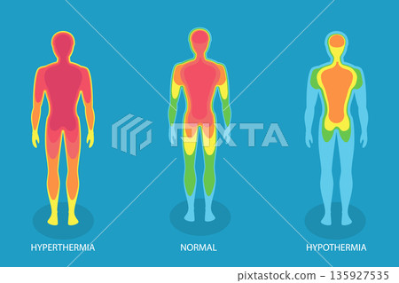 3D Isometric Flat Vector Illustration of Human Body Temperature, Hyperthermia And Hypothermia 135927535