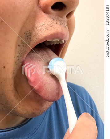 A middle-aged man cleans his tongue with a tongue brush. A middle-aged man cleans his tongue with a tongue brush. 135934193