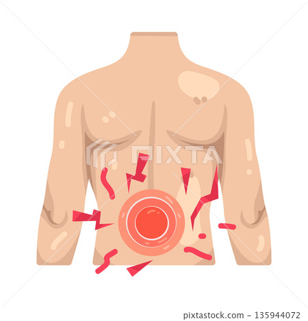 Illustration of Abdominal pain Illustration of Abdominal pain 135944072