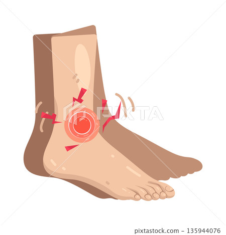 Illustration of ankle pain Illustration of ankle pain 135944076
