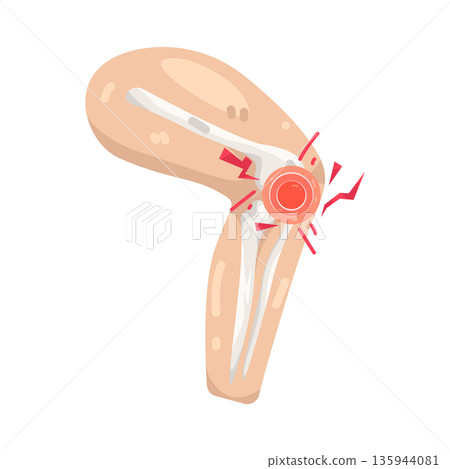 Illustration of knee pain Illustration of knee pain 135944081