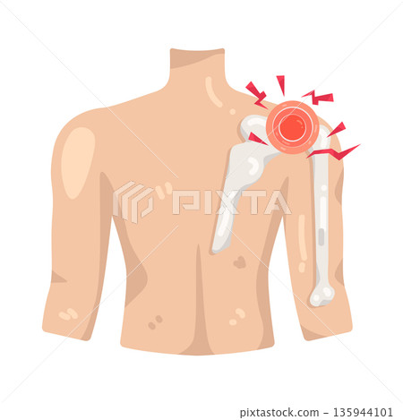 Illustration of shoulder pain 135944101