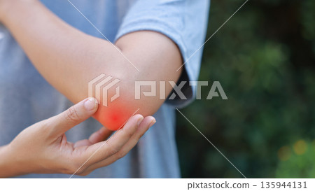 Close-up of woman hand holding painful injured elbow with red inflamed spot. Concept of joint bone pain, muscle injury, arthritis, tendonitis, or ache from sports or work in outdoor background. Close-up of woman hand holding painful injured elbow with red inflamed spot. Concept of joint bone pain, muscle injury, arthritis, tendonitis, or ache from sports or work in outdoor background. 135944131