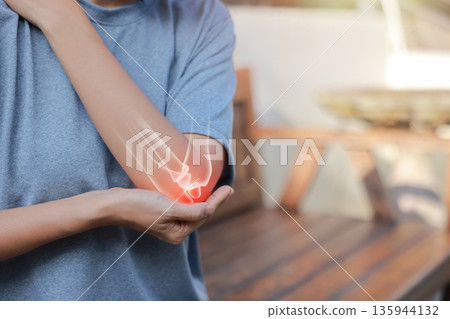 Close-up woman holding painful injured elbow with red inflamed spot and X-ray bone skeleton overlay. Medical concept of joint pain, fracture, arthritis, tendonitis, muscle injury, outdoor background. Close-up woman holding painful injured elbow with red inflamed spot and X-ray bone skeleton overlay. Medical concept of joint pain, fracture, arthritis, tendonitis, muscle injury, outdoor background. 135944132