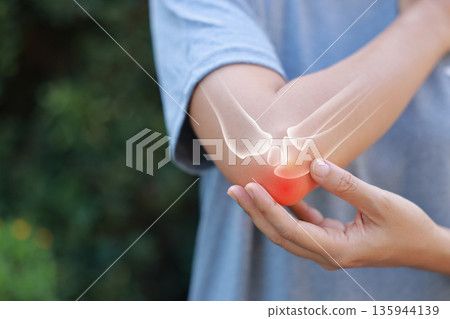 Close-up woman holding painful injured elbow with red inflamed spot and X-ray bone skeleton overlay. Medical concept of joint pain, fracture, arthritis, tendonitis, muscle injury, outdoor background. Close-up woman holding painful injured elbow with red inflamed spot and X-ray bone skeleton overlay. Medical concept of joint pain, fracture, arthritis, tendonitis, muscle injury, outdoor background. 135944139