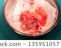 Brain Tumor Surgical Specimen 135951057