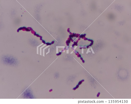 Streptococcus lactis, found in yogurt Streptococcus lactis, found in yogurt 135954130