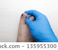 Medical pedicure treatment showing toe nail tamponade to prevent ingrown toenail. Podiatry procedure with cotton packing, antiseptic care and nail correction. 135955300