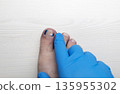 Medical pedicure treatment showing toe nail tamponade to prevent ingrown toenail. Podiatry procedure with cotton packing, antiseptic care and nail correction. 135955302