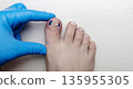 Medical pedicure treatment showing toe nail tamponade to prevent ingrown toenail. Podiatry procedure with cotton packing, antiseptic care and nail correction. 135955305