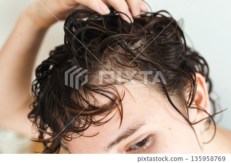 early baldness in women early baldness in women 135958769