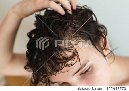 early baldness in women early baldness in women 135958770