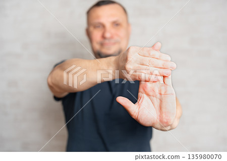 Man doing therapeutic exercises, streching his wrist 135980070