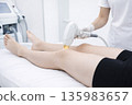 having laser hair removal on legs, generative AI 135983657