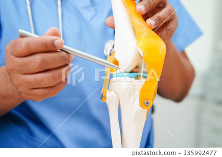 Asian doctor holding spinal nerve and bone model, Lumbar spine displaced herniated disc fragment for treatment medical in the orthopedic department. 135992477