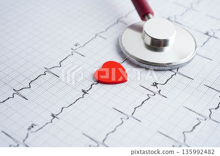 Stethoscope on electrocardiogram (ECG), heart wave, heart attack, cardiogram report. Stethoscope on electrocardiogram (ECG), heart wave, heart attack, cardiogram report. 135992482