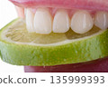 Close up of female teeth biting lime slice showing ceramic veneers and natural dental care concept 135999393