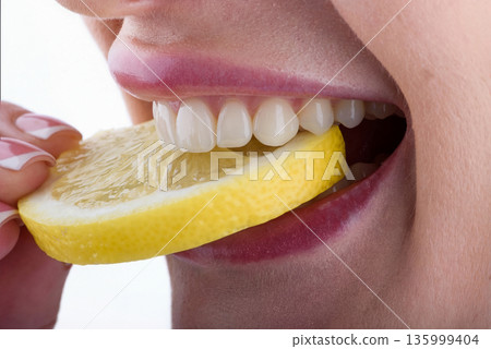Close up of female teeth biting lemon slice showing ceramic veneers and natural dental care concept Close up of female teeth biting lemon slice showing ceramic veneers and natural dental care concept 135999404