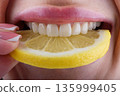 Close up of female teeth biting lemon slice showing ceramic veneers and natural dental care concept 135999405