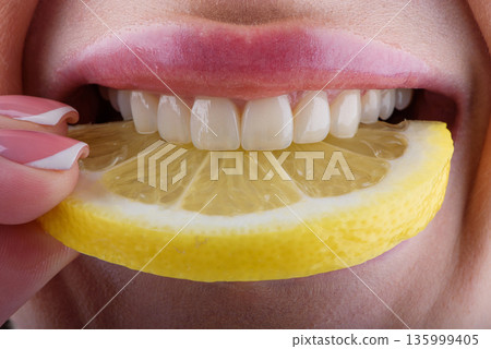 Close up of female teeth biting lemon slice showing ceramic veneers and natural dental care concept Close up of female teeth biting lemon slice showing ceramic veneers and natural dental care concept 135999405