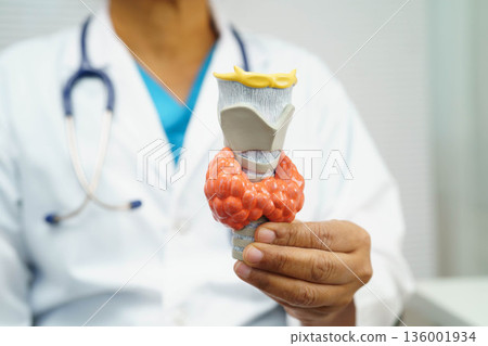 Hyperthyroidism, Overactive Thyroid, Thyroid Lymphoma, Asian doctor with thyroid gland human anatomy model in hospital. Hyperthyroidism, Overactive Thyroid, Thyroid Lymphoma, Asian doctor with thyroid gland human anatomy model in hospital. 136001934