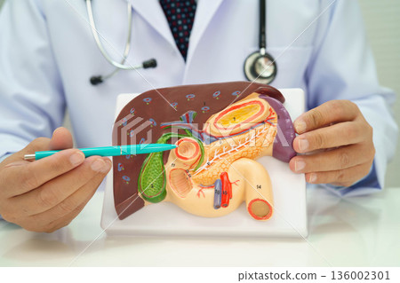 Cirrhosis, Liver cancer, fatty liver, Asian doctor with liver human anatomy model in World Hepatitis Day at hospital. 136002301