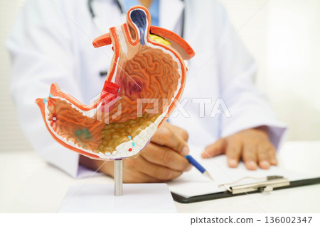 Stomach disease, doctor holding anatomy model for study diagnosis and treatment in hospital. Stomach disease, doctor holding anatomy model for study diagnosis and treatment in hospital. 136002347