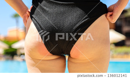 Red marks on the buttocks from sitting on a chair for a long time Red marks on the buttocks from sitting on a chair for a long time 136012141