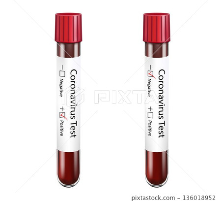 Test tubes with positive and negative results for coronavirus, isolated on white background. Chinese coronavirus or Covid 2019 blood test concept. Vector 3D realistic illustration. Test tubes with positive and negative results for coronavirus, isolated on white background. Chinese coronavirus or Covid 2019 blood test concept. Vector 3D realistic illustration. 136018952