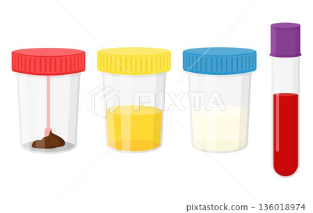 Laboratory tests. Test urine, feces, semen, and blood in plastic jars with colored lids Laboratory tests. Test urine, feces, semen, and blood in plastic jars with colored lids 136018974