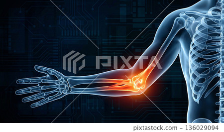 Illustration of elbow pain and inflammation. Skeletal X-ray of tennis elbow and baseball elbow. 3DCG advertising material. Tags Illustration of elbow pain and inflammation. Skeletal X-ray of tennis elbow and baseball elbow. 3DCG advertising material. Tags 136029094