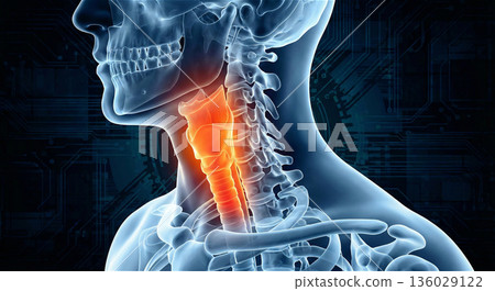 Illustration of sore throat and inflammation, tonsils, vocal cords, esophagus, skeletal X-ray, 3DCG, advertising material 136029122